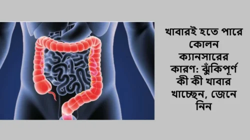 খাবারই হতে পারে কোলন ক্যানসারের কারণ: ঝুঁকিপূর্ণ কী কী খাবার খাচ্ছেন, জেনে নিন