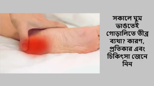 সকালে ঘুম ভাঙতেই গোড়ালিতে তীব্র ব্যথা? কারণ, প্রতিকার এবং চিকিৎসা জেনে নিন